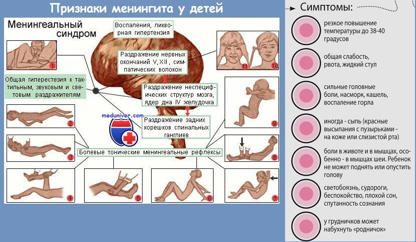 Судороги неуточненные карта вызова