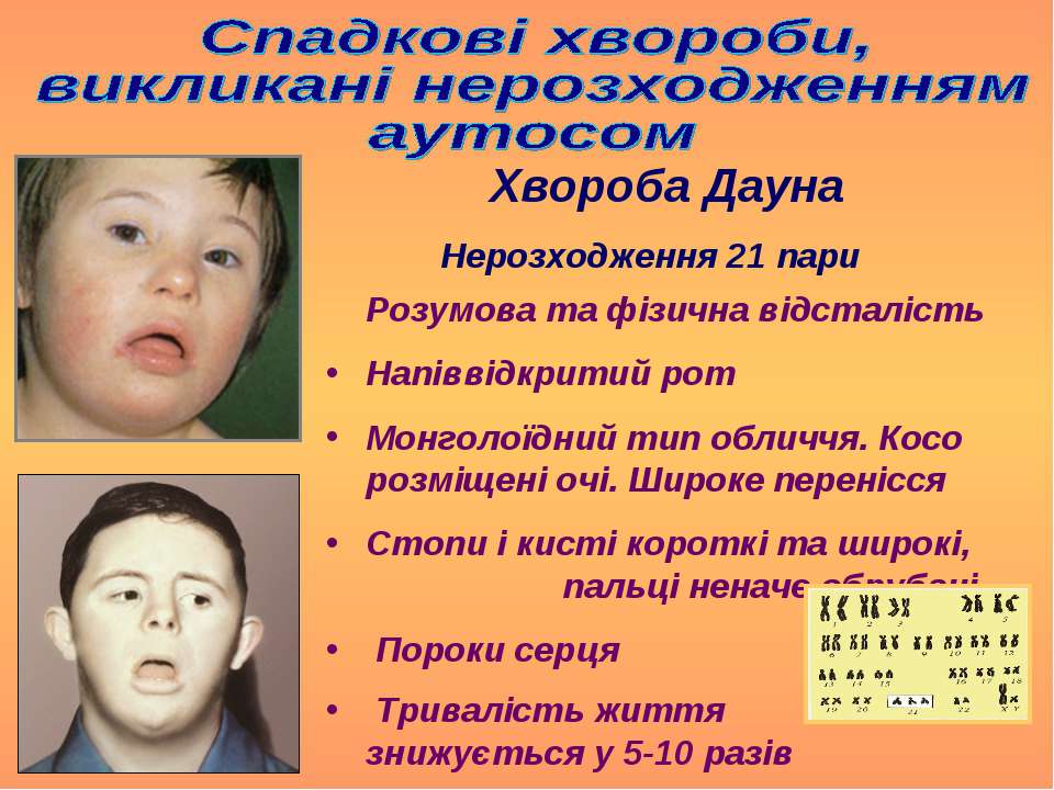 Роды дауна. Размер и форма черепа при синдроме Дауна. Хвороба Дауна симптомы.