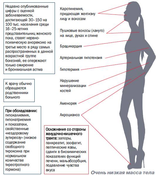 Признаки вес. Заболевания потери веса. Нервная анорексия осложнения.